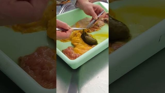 Анатомия  Общая пищеварительная система.