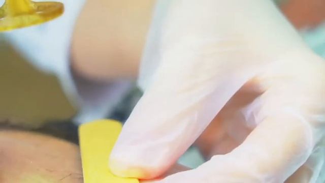 Отзыв о эпиляции в Laser Best смотреть онлайн