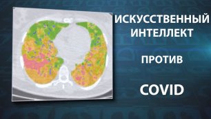 Программа оценки степени поражения лёгких при коронавирусе COVID-19 «Гамма Мультивокс Ковирус»
