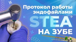 Протокол работы файлами STEA на удалённом Зубе | TC-Files| V-Glider| K-Files