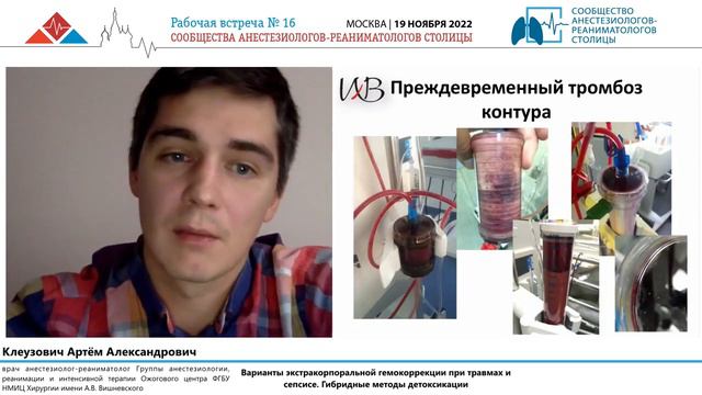 Экстракорп ГК и ЗПТ при травме и шоке Кузовлевич А.А. смотреть онлайн