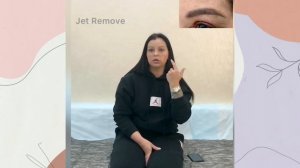 Удаление татуажа двойных хвостов бровей ПОСЛЕ удаления кислотным ремуверм