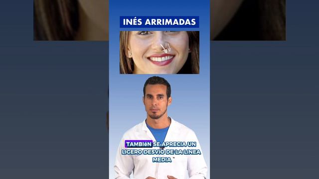 INÉS ARRIMADAS - Un dentista ANALIZA sus DIENTES y SONRISA #dientes