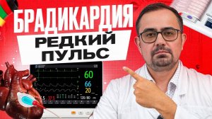 Пульс меньше 60 – норма или паталогия? Причины и лечение редкого пульса (брадикардия)