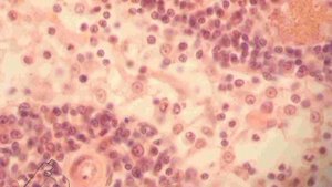 РЕТИКУЛЯРНАЯ ТКАНЬ