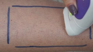 Первое использование эпилятора Braun