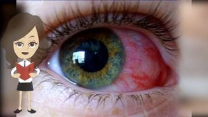 Страшные последствия наращивания ресниц, от выпадения до живущих в ресницах насекомых