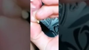 Давить прыщи//Make Your day Relaxing// залипательное видео// чёрные точки выдавливание угри //