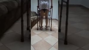 Исправление кривых ног