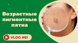 #61 Возрастные пигментные пятна