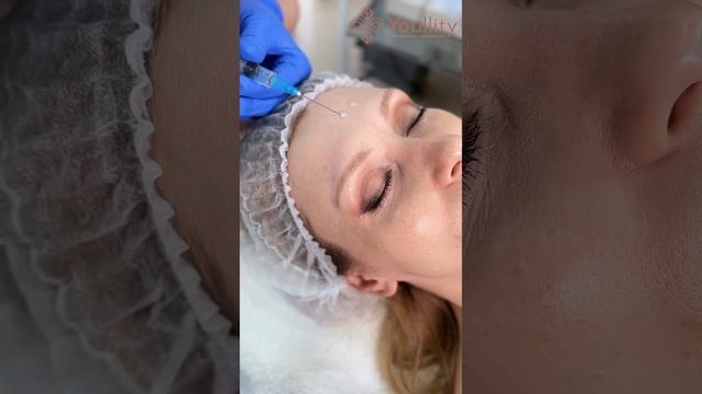 WOW пилинг в Youllity смотреть онлайн