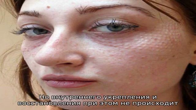 Ботокс ресниц – здоровый объем и выразительный взгляд без туши