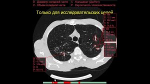 Искуственный интелект работает с КТ