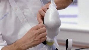 Изготовление пробного протеза и культеприемной гильзы. Для специалистов по протезированию рук