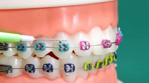 Щетка для чистки межзубного пространства 60 шт https://2my.site/5Du8EyP