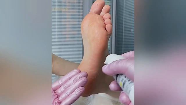 Обработка стопы ?? смотреть онлайн