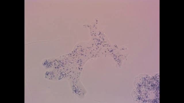 Mikroskopiesafari: Amoeba proteus смотреть онлайн