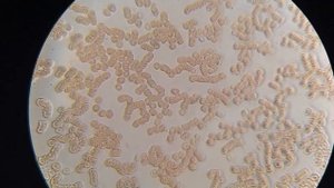 Кровь после полоскания рта маслом