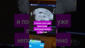 Как я делаю биопсию предстательной железы под местным обезболиванием © уролог Д.М. Ильин