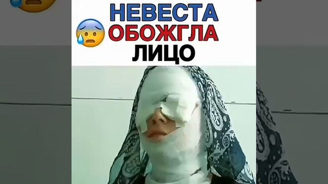 Невеста обожгла лицо смотреть онлайн