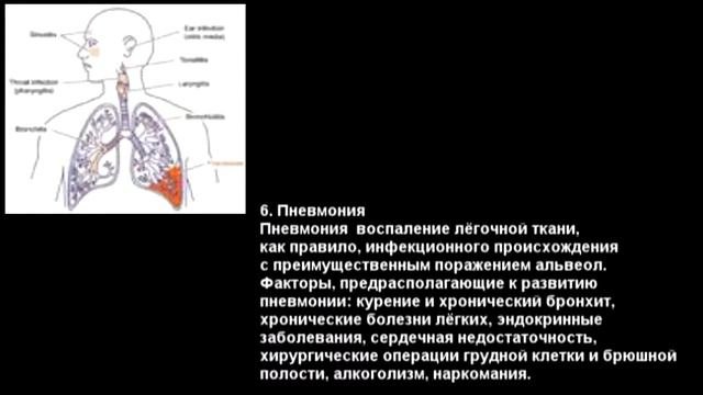 ТОП 10 самый опасных болезней для человека! Самые Страшные и Опасные!