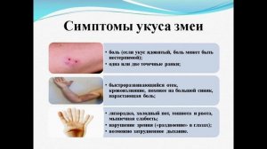 Тема 12. Укусы животными: алгоритм оказания первой помощи