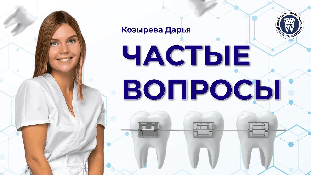 Частые вопросы ортодонту