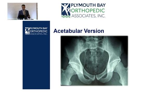 Femoroacetabular Impingement: Evaluation and Management - SMOS 2023 смотреть онлайн