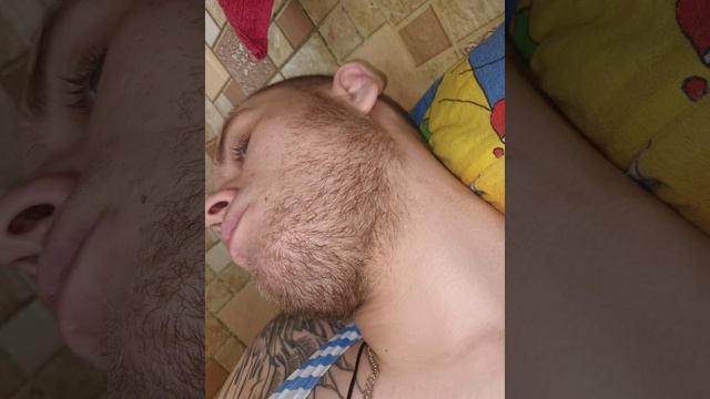 Миноксидил Результаты 6мес+ смотреть онлайн