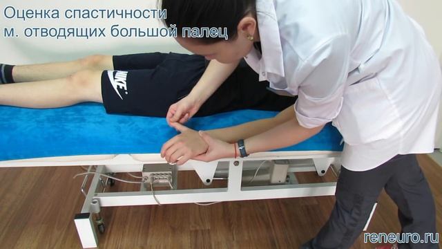 Оценка спастичности м. отводящих большой палец по модифицированной шкале Эшворта