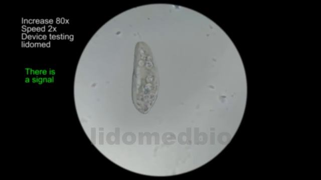 Бактерия инфузории туфельки смотреть онлайн