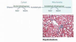 ПИТАНИЕ --- 6.Nutritions ----- Ethanol Metabolism.mp4
