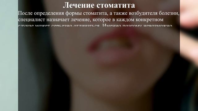 Стоматит: причины, симптомы, лечение заболевания.