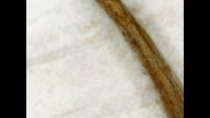 Рябина под микроскопом