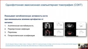 Дифференциальная диагностика болевого синдрома после эндопротезирования тазобедренного сустава.