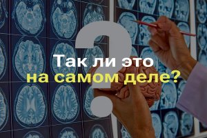 МОЗГ ЧЕЛОВЕКА РАБОТАЕТ НА 10 ПРОЦЕНТОВ I МИФ ОБ ИСПОЛЬЗОВАНИИ МОЗГЕ I ОПРОВЕРЖЕНИЕ