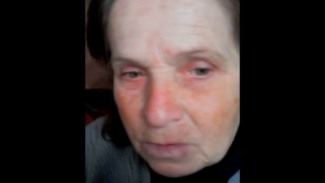 Результат применения крема!!!!!!!!!