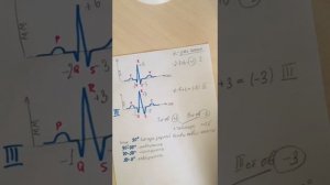 ЭКГ(электрическая ось сердца, угол альфа)