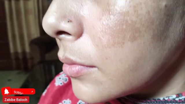 Hide pigmentation #pigmentationtreatment #darkspotstreatment #removedarkspots #zabibebaloch