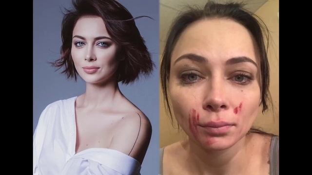 Екатерина Волкова. Фото в купальнике, без фотошопа, до пластики и после. Фигура,