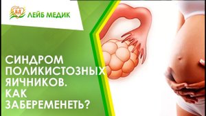 ?_? Как забеременеть с синдромом поликистозных яичников?