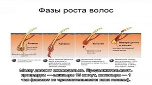 Линия роста волос на лбу: что это такое и можно ли ее скорректировать