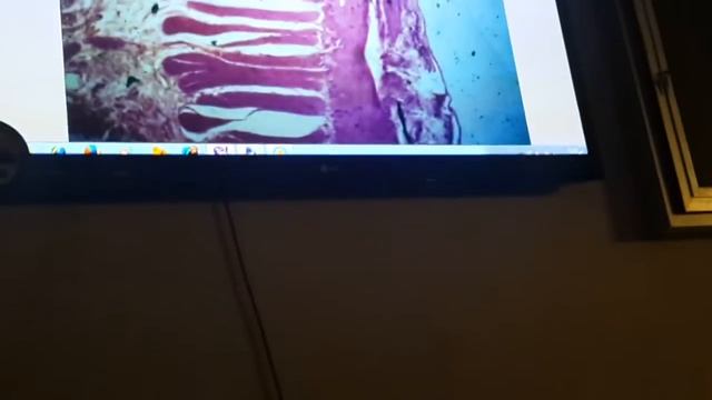 GIT Histology - Small & Large Intestines смотреть онлайн