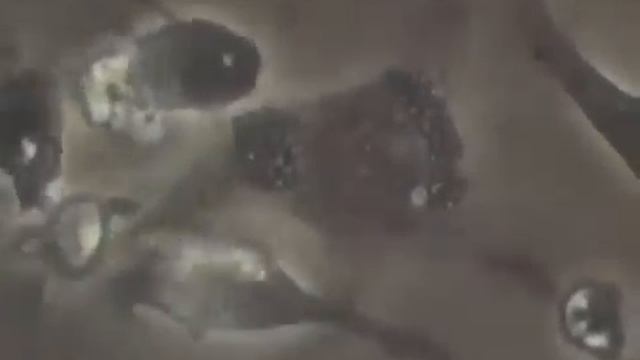 Болезнетворные бактерии человека СТОЛБНЯК