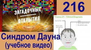 Синдром Дауна - развитие, признаки (учебное видео). З/О_216.