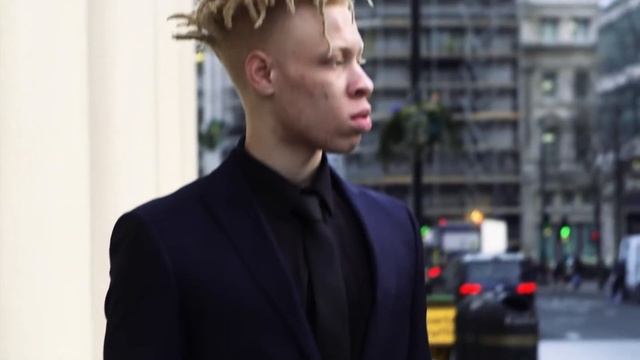 Все Смеялись над Мальчиком Альбиносом. Спустя время Его история потрясла весь МИР... Лео Джона смотреть онлайн