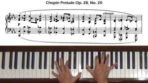 Chopin Prelude Op. 28, No. 20 in C minor Piano Tutorial