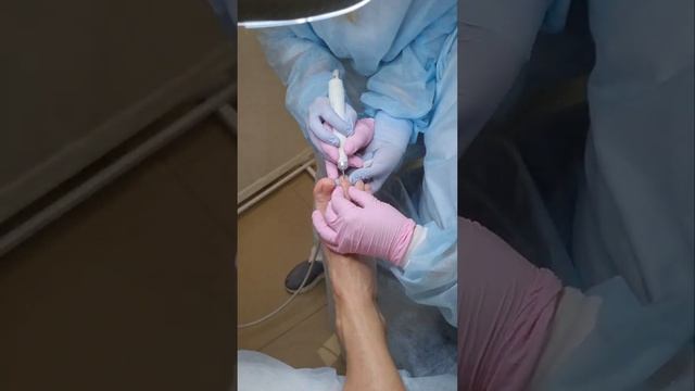 Обучение подологии. Курс обучения аппаратному педикюру с основами подологии. Этап отработки. смотреть онлайн