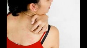 Кожная сыпь Лучший Варианты лечения