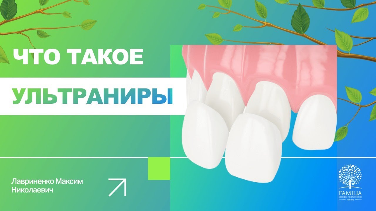 ➡ Ультраниры - что это такое?